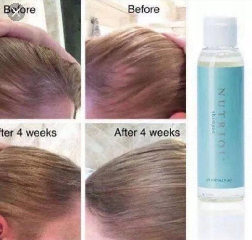 nutriol szampon na porost włosów