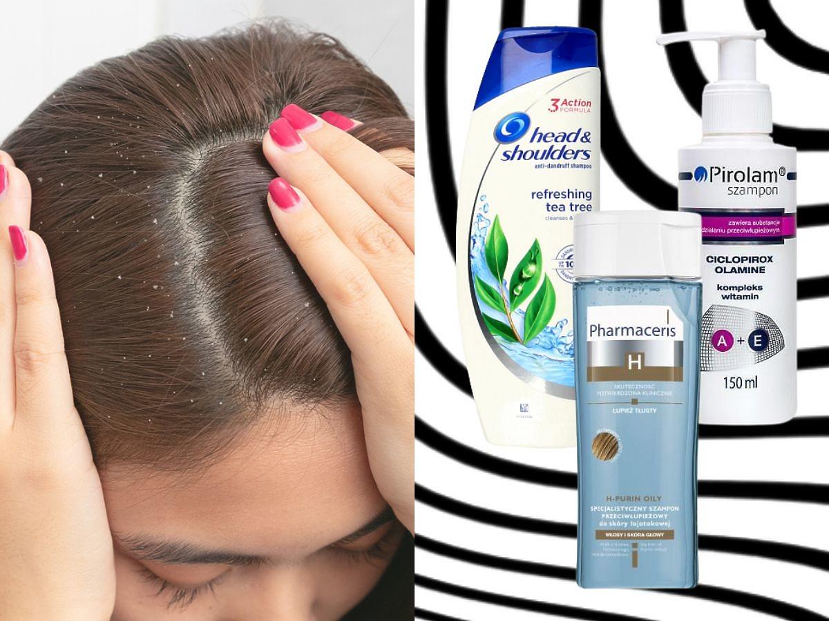 przeciwlupiezowy szampon dziala po 1 uzyciu na stale usowa lupiez