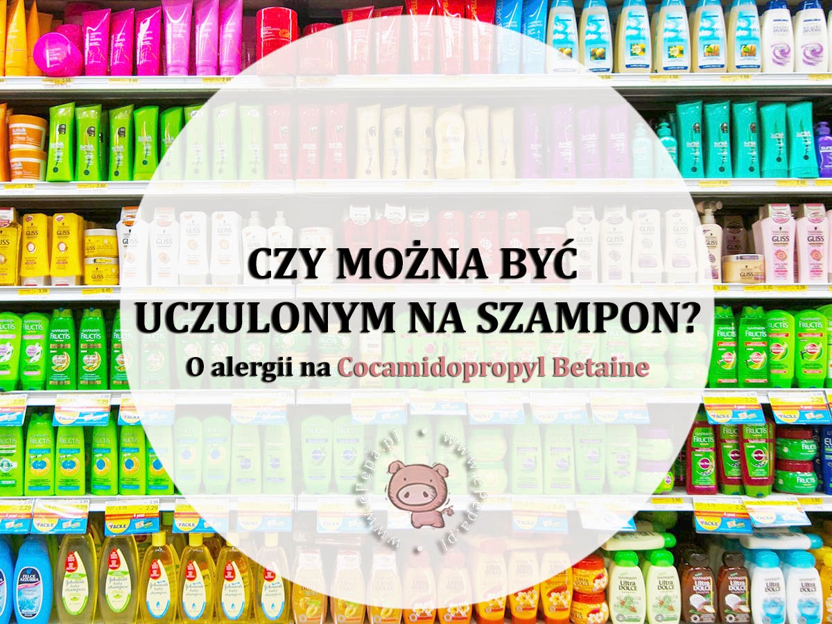 alergia na szampon objawy