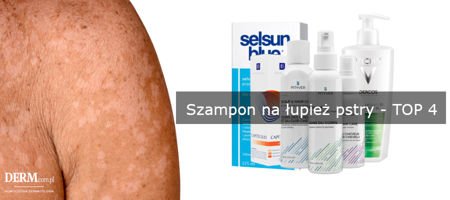 łupież pstry jaki szampon