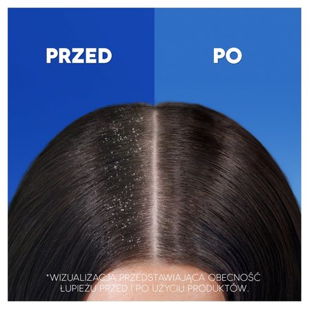 head & shoulders szampon przeciwłupieżowy z odżywką 2w1