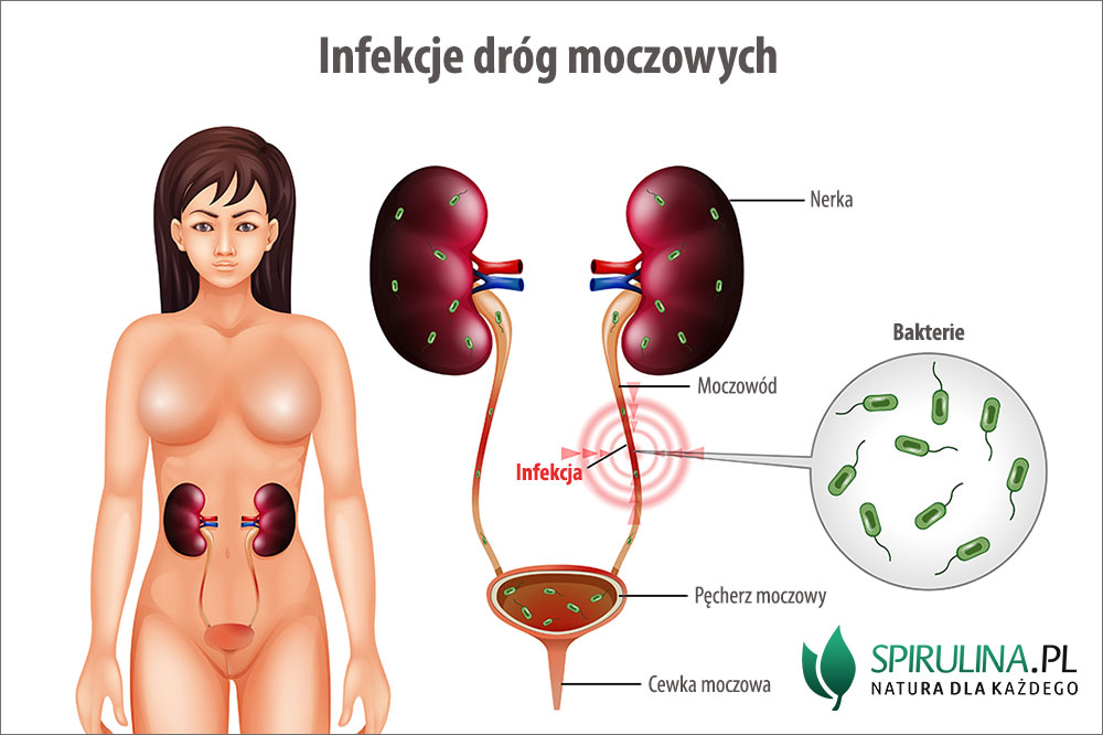 oduczanie pieluchy infekcja układu moczowego