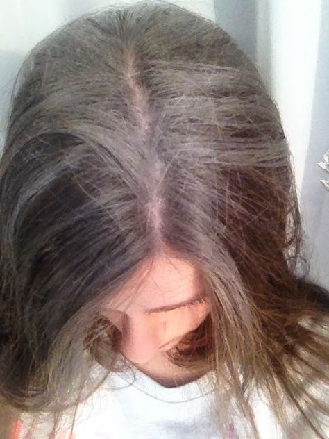 siwe włosy przez suchy szampon